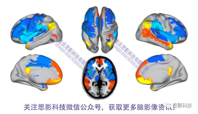 思影科技功能磁共振(fmri)数据处理业务